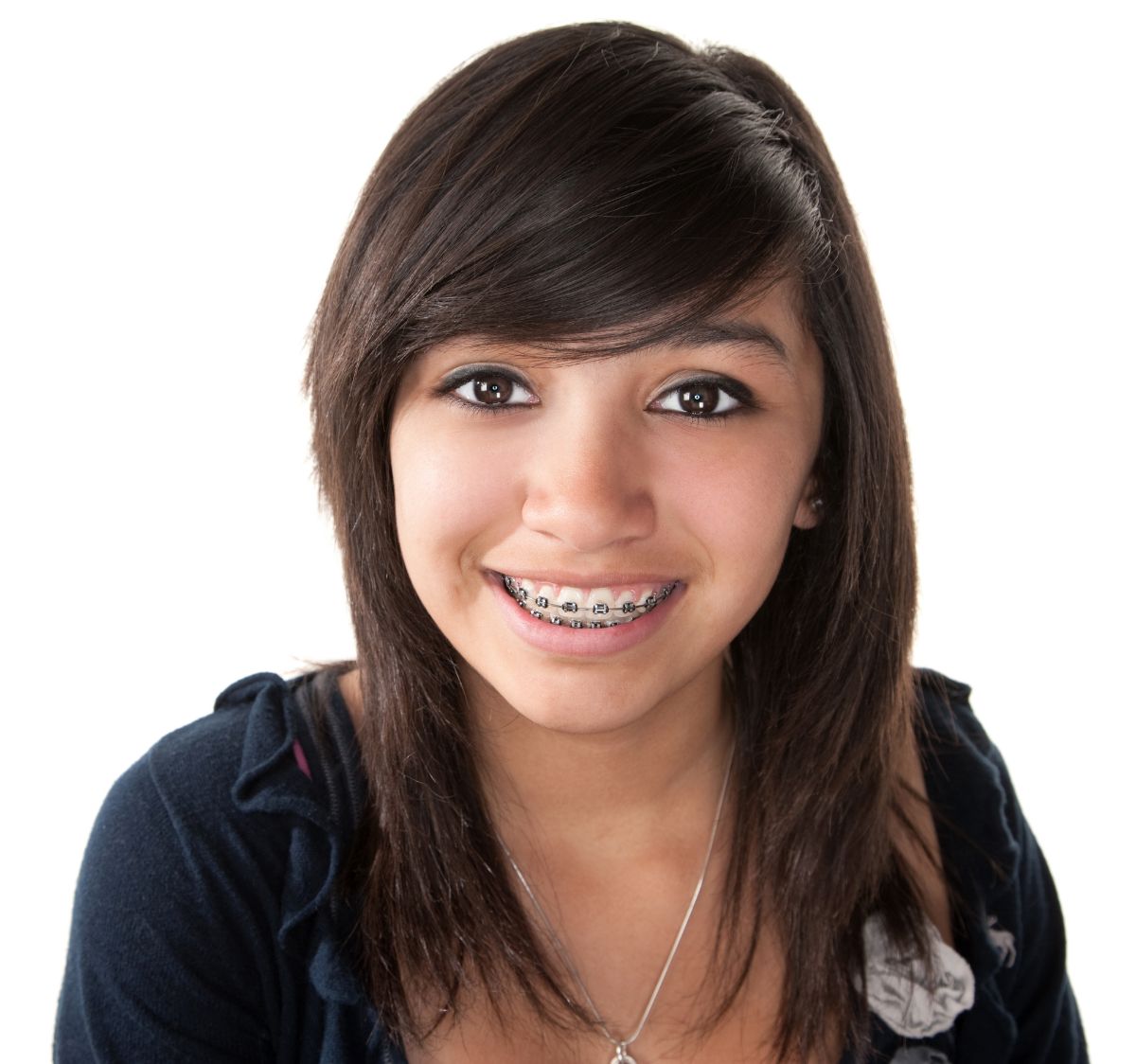 Braces or Invisalign: Which Option Is Right For Me?