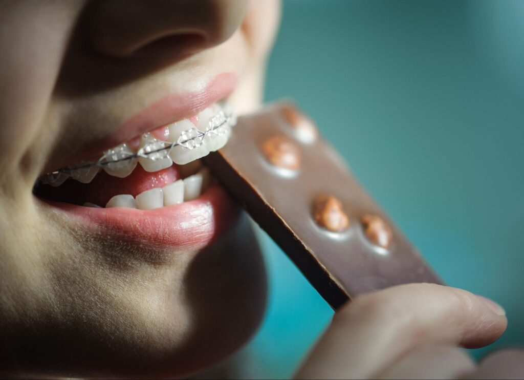 Your Guide to Healthy Dining in Madison While Wearing Braces